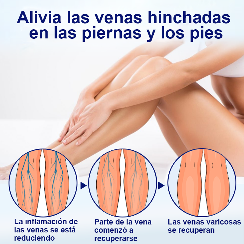 💙Aprobado por la FDA🌿ODEIUN™ VeinFreedom Spray Herbario - Terapia de MicroNiebla