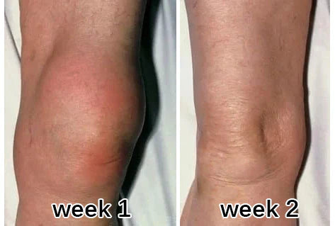 Knee week 1 week 2 customer review