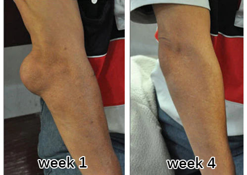 Elbow week 1 week 4 customer review