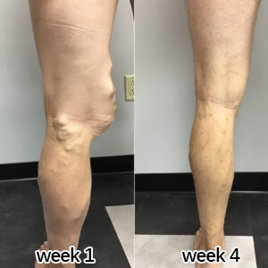 Knee comfort customer review