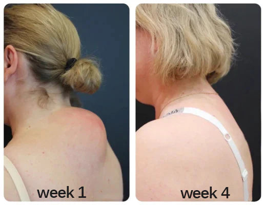 Neck and shoulder week 1 week 4 customer review