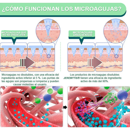 【Último día de promoción: 60% DE DESCUENTO🏅】JEREMYTIS™ Parche NANO de microagujas NIDDK-Tirzepatide para Adelgazar y Salud(Sin dolor, liberación 24/7 | Pierde 9 kg RÁPIDO | Reducción del 90% en azúcar | )🌸