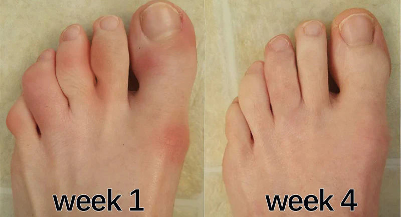 Foot week 1 week 4 customer review