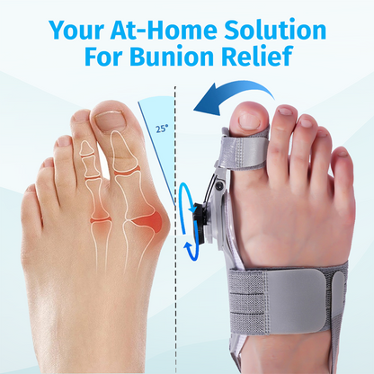 🔥Last Day Buy 1 get 1 free—49% off🔥JEREMYTIS™Adjustable Hallux Valgus Brace👣